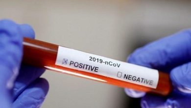 الصين اكتشاف سلالة ثانية من فيروس كورونا أكثر فتكا وعدوانية