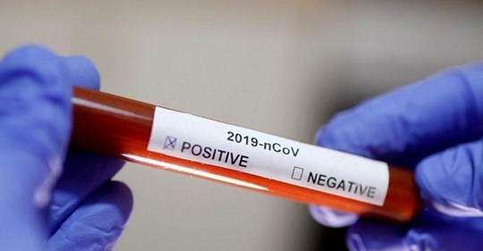 الصين اكتشاف سلالة ثانية من فيروس كورونا أكثر فتكا وعدوانية