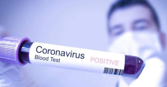 جربة 12 إصابة جديدة بفيروس كورونا‎