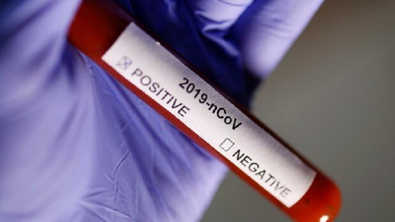 تسجيل أول إصابة وافدة بفيروس كورونا في قرمبالية