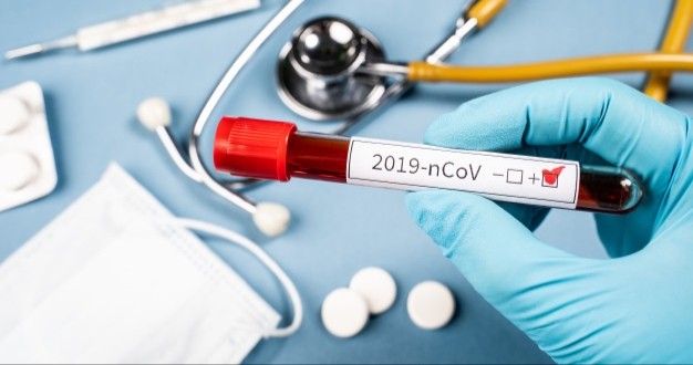 سوسة تسجيل 02 اصابات محلية جديدة بفيروس كورونا