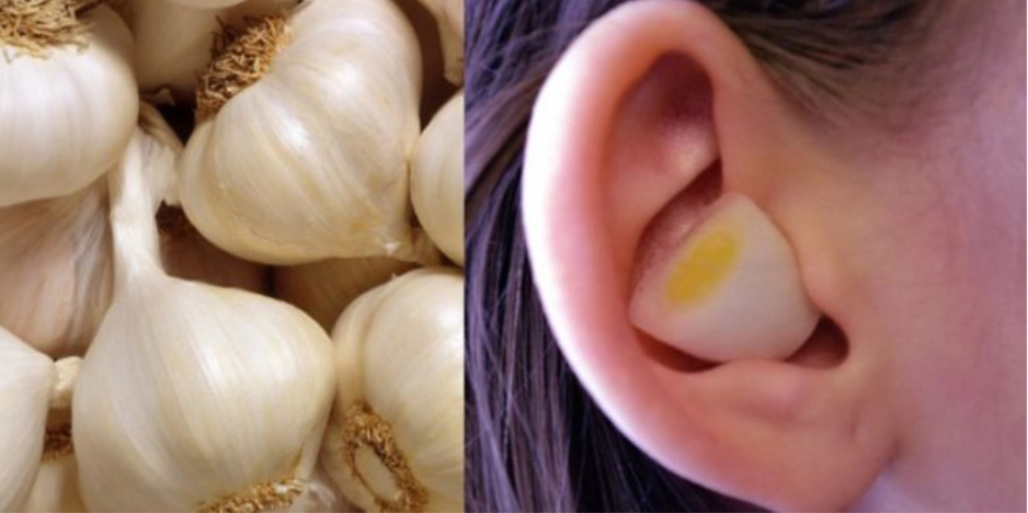 Mettez de l’ail et un oignon dans votre oreille et regarder le résultat