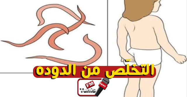 التخلص من الحكه والديدان